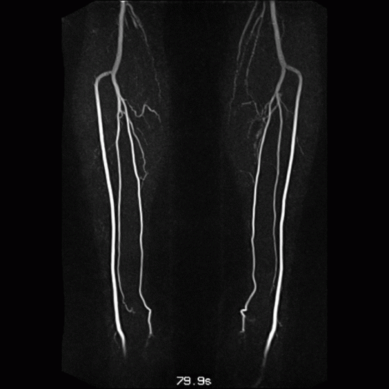 Swallowing in Radiology – Medical GIF